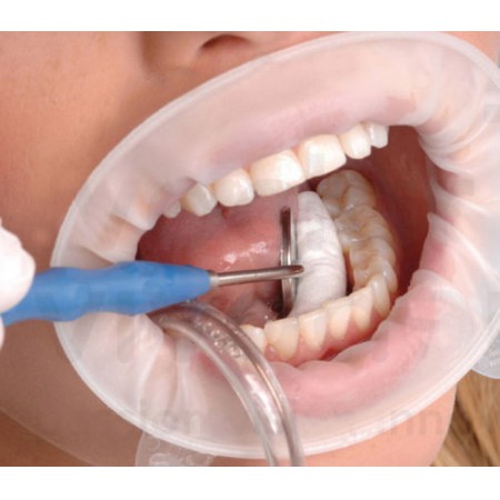 Dentalclick France  Distributeur de produits dentaires ECARTEUR